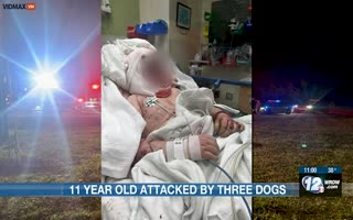 11 Year Old Boy Is Attacked By 3 Pit Bulls, Loses Ear And Most Of His Scalp