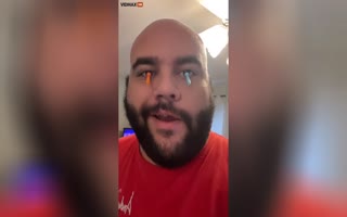 Guy Puts Suction Cups on his EYEBALL to Explain how Eyes Work