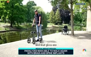 Paralyzed Man Is Again Able To Walk With An Inplant In His Brain And Spine