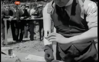 Prosthetic Arm From 1921 Was AMAZING!
