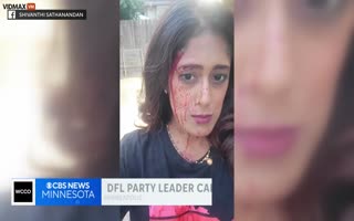 LOL, Democrat Leader In Minnesota Who Promised To Dismantle The Police Gets Beaten Bloody And Carjacked